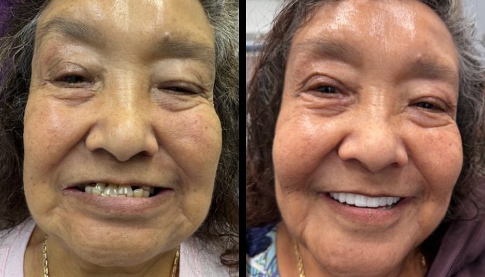 Before After Image